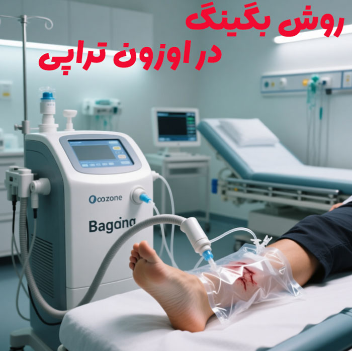 روش بگینگ  در اوزون تراپی زخم 