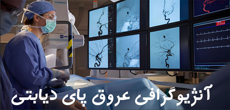 آنژیوگرافی عروق پا