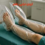 ازون تراپی زخم