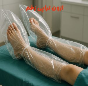 ازون تراپی زخم