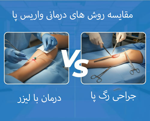 مقایسه-لیزر-واریس-پا-یا-سایر-روش-های-درمانی؟ مقایسه لیزر واریس پا یا سایر روش های درمانی؟