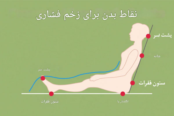 نواحی پرخطر پاشنه و باسن نواحی پرخطر پاشنه و باسن