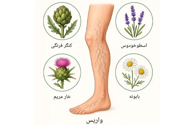 گیاهان دارویی موثر بر واریس