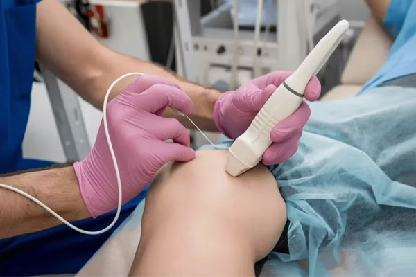 لیزر درمانی (Endovenous Laser Therapy) لیزر درمانی (Endovenous Laser Therapy)