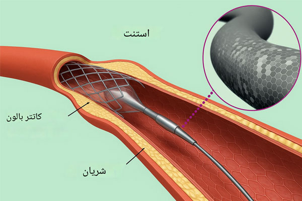 بیماری‌های عروقی