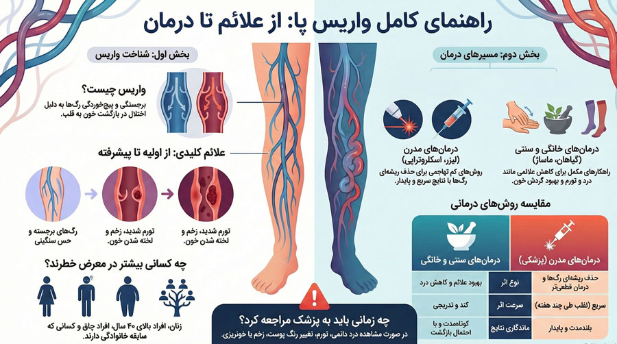 درمان-واریس