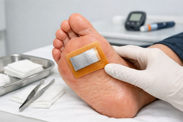 پانسمان نقره و ید؛ راه حل عفونت پانسمان نقره و ید؛ راه حل عفونت