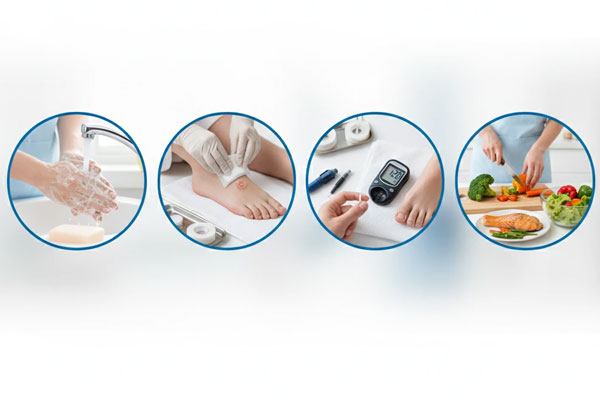 راهنمای مراقبت خانگی زخم پای دیابتی در چهار گام راهنمای مراقبت خانگی زخم پای دیابتی در چهار گام