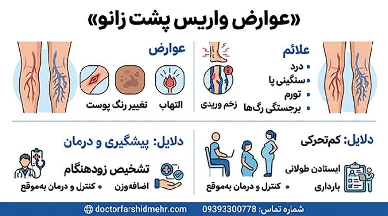 عوارض واریس پشت زانو عوارض واریس پشت زانو