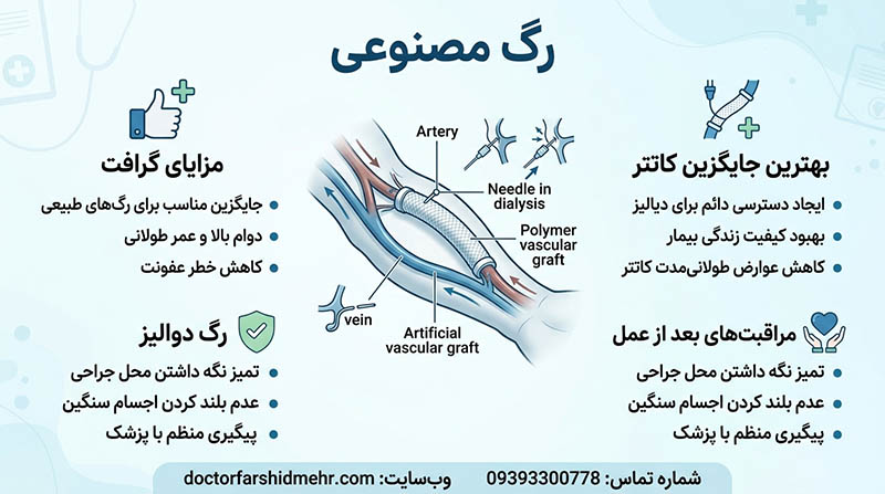 رگ مصنوعی