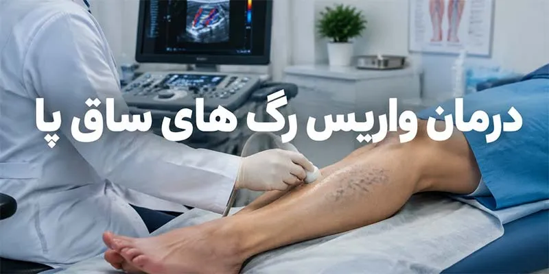درمان-واریس-ساق-پا درمان واریس رگ های ساق پا