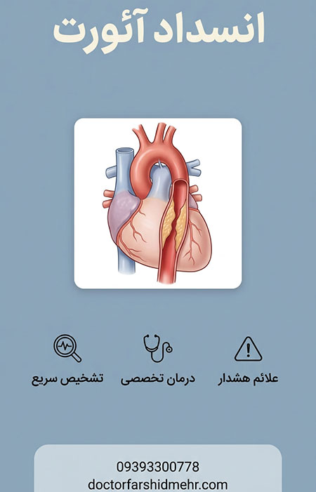 انسداد آئورت انسداد آئورت