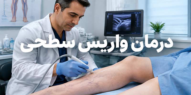 درمان واریس سطحی