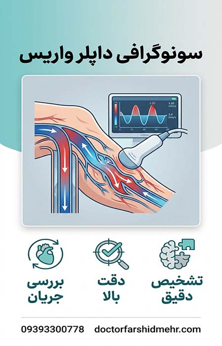 سونوگرافی داپلر واریس
