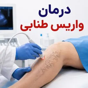 واریس طنابی