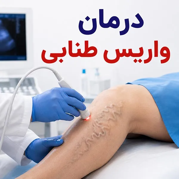واریس طنابی